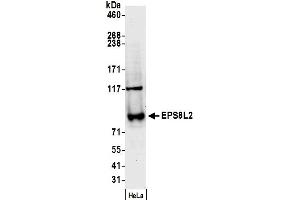 Western Blotting (WB) image for anti-EPS8-Like 2 (EPS8L2) (AA 600-650) antibody (ABIN7450214)