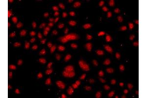 Immunofluorescence analysis of  cells using FBXW11 antibody (ABIN6133150, ABIN6140529, ABIN6140530 and ABIN6223739). (FBXW11 抗体  (AA 1-140))