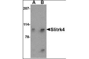 Western blot analysis of Slitrk4 in mouse brain tissue lysate with this product at (A) 0. (SLITRK4 抗体  (N-Term))