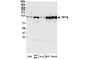 Western Blotting (WB) image for anti-Tripartite Motif Containing 24 (TRIM24) (AA 700-750) antibody (ABIN7454678) (TRIM24 抗体  (AA 700-750))