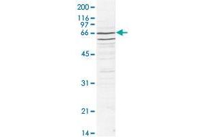 Western blot was performed using nuclear extracts from HeLa cells (HeLa NE, 20 ug) and the CDC73 polyclonal antibody  at dilution 1 : 1,000 in TBS-Tween + 5% skimmed milk. (HRPT2 抗体)