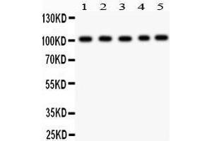 Western Blotting (WB) image for anti-Solute Carrier Family 4, Anion Exchanger, Member 1 (erythrocyte Membrane Protein Band 3, Diego Blood Group) (SLC4A1) (AA 28-365) antibody (ABIN3043930)