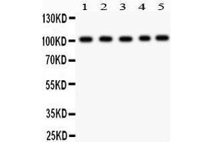 Anti- Band 3 Picoband antibody, Western blotting All lanes: Anti Band 3  at 0. (Band 3/AE1 抗体  (AA 28-365))