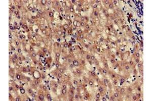 Immunohistochemistry of paraffin-embedded human liver tissue using ABIN7163511 at dilution of 1:100 (KLKB1 抗体  (AA 503-612))