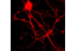 Immunocytochemistry on cultured hippocampus neurons (dilution 1 : 500). (SNAP alpha/beta 抗体)