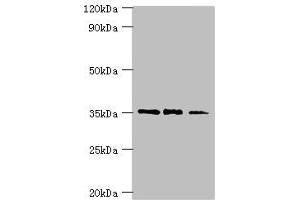 Western blot All lanes: FOSL2 antibody at 8 μg/mL Lane 1: MCF-7 whole cell lysate Lane 2: Jurkat whole cell lysate Lane 3: PC-3 whole cell lysate Secondary Goat polyclonal to rabbit IgG at 1/10000 dilution Predicted band size: 36, 35, 32 kDa Observed band size: 36 kDa (FOSL2 抗体  (AA 187-326))