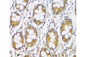 Immunohistochemistry of paraffin-embedded Human colon using ERLIN1 Polyclonal Antibody at dilution of 1:100 (40x lens). (ERLIN1 抗体)