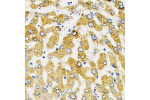 Immunohistochemistry of paraffin-embedded human liver using SLC27A2 antibody (ABIN1874822) at dilution of 1:100 (40x lens). (SLC27A2 抗体)