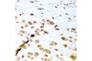 Immunohistochemistry (IHC) image for anti-ELAV-Like 3 (ELAVL3) (AA 1-100) antibody (ABIN6140118)