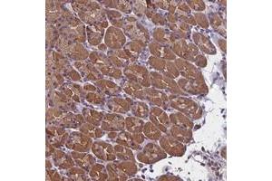 Immunohistochemical staining of human stomach with SYCE2 polyclonal antibody  shows moderate cytoplasmic positivity in glandular cells. (SYCE2 抗体)