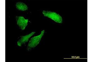 Immunofluorescence of purified MaxPab antibody to STK11 on HeLa cell. (LKB1 抗体  (AA 1-433))