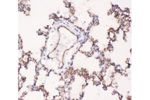 IHC-P testing of rat lung tissue (Angiotensin I Converting Enzyme 1 抗体  (AA 651-864))