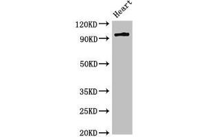 Western Blot Positive WB detected in: Rat heart tissue All lanes: PRKD3 antibody at 3 μg/mL Secondary Goat polyclonal to rabbit IgG at 1/50000 dilution Predicted band size: 101, 69 kDa Observed band size: 101 kDa (PRKD3 抗体  (AA 326-510))