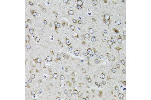 Immunohistochemistry of paraffin-embedded mouse brain using RPS10 antibody (ABIN1980247) at dilution of 1:100 (40x lens). (RPS10 抗体)