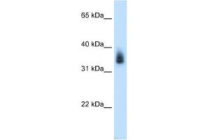 MAGEA8 antibody used at 0. (MAGEA8 抗体  (N-Term))