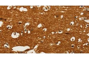 Immunohistochemistry of paraffin-embedded Human brain using GOT1 Polyclonal Antibody at dilution of 1:50 (GOT1 抗体)
