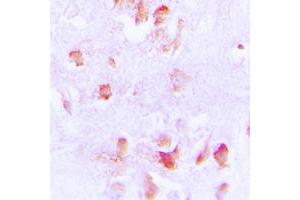 Immunohistochemical analysis of Creatine Kinase M staining in human brain formalin fixed paraffin embedded tissue section. (CKM 抗体  (N-Term))