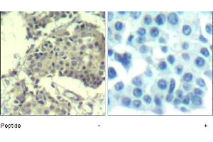 Image no. 1 for anti-Mechanistic Target of Rapamycin (serine/threonine Kinase) (mTOR) (Ser2481) antibody (ABIN401643) (MTOR 抗体  (Ser2481))