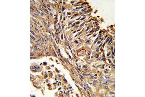 Immunohistochemistry (Paraffin-embedded Sections) (IHC (p)) image for anti-Interleukin 18 Receptor Accessory Protein (IL18RAP) (AA 73-101), (N-Term) antibody (ABIN652745)