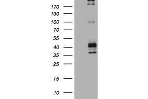 Image no. 2 for anti-Fc Fragment of IgE, Low Affinity II, Receptor For (CD23) (FCER2) (AA 48-321) antibody (ABIN1491553)