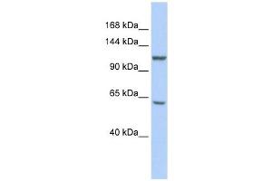 MCM8 antibody used at 1 ug/ml to detect target protein. (MCM8 抗体  (N-Term))