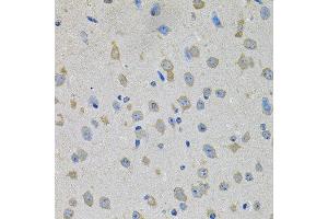 Immunohistochemistry of paraffin-embedded mouse brain using PTK7 antibody at dilution of 1:100 (x40 lens). (PTK7 抗体)