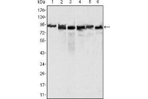 Western blot analysis using MLH1 mouse mAb against Hela (1), MCF-7 (2) and A549 (3), Jurkat (4), 2R75 (5) and COS (6) cell lysate. (MLH1 抗体  (AA 381-483))