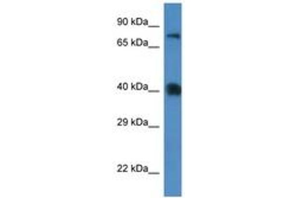 SLC7A3 抗体  (AA 130-179)