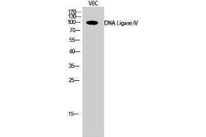 Western Blotting (WB) image for anti-Ligase IV, DNA, ATP-Dependent (LIG4) (Internal Region) antibody (ABIN3184324) (LIG4 抗体  (Internal Region))