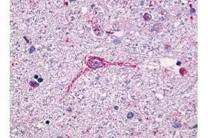 Immunohistochemical staining of Brain (Neurons and glia) using anti- NTSR1 antibody ABIN122340 (NTSR1 抗体  (N-Term))