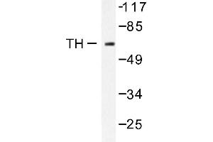 Image no. 1 for anti-Tyrosine Hydroxylase (TH) antibody (ABIN271919) (Tyrosine Hydroxylase 抗体)