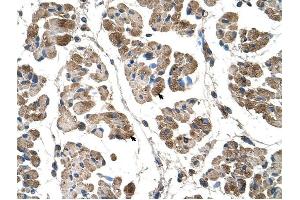 Alpha Actinin 2 antibody was used for immunohistochemistry at a concentration of 4-8 ug/ml to stain Skeletal muscle cells (arrows) in Human Muscle.