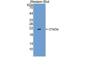 Western Blotting (WB) image for anti-Integrin Alpha2b (CD41) (AA 891-1039) antibody (ABIN1868769) (Integrin Alpha2b 抗体  (AA 891-1039))