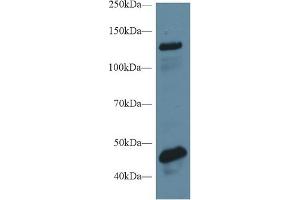 Detection of MGEA5 in Rat Cerebrum lysate using Polyclonal Antibody to Meningioma Expressed Antigen 5 (MGEA5) (MGEA5 抗体  (AA 6-240))