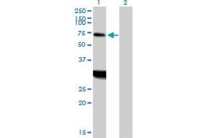 Western Blot analysis of ZNF238 expression in transfected 293T cell line by ZNF238 MaxPab polyclonal antibody. (ZNF238 抗体  (AA 1-522))