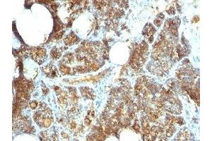 Formalin-fixed, paraffin-embedded human parathyroid stained with Parathyroid Hormone antibody (PTH/1173). (PTH 抗体  (AA 32-115))