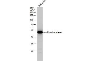 WB Image Creatine kinase (brain) antibody detects Creatine kinase protein by western blot analysis. (CKB 抗体)