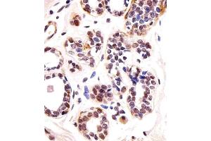 Immunohistochemical analysis of paraffin-embedded H. (T-Box 1 抗体  (C-Term))