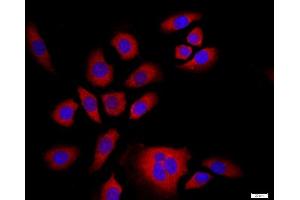 Immunofluorescence (Cultured Cells) (IF (cc)) image for anti-Nuclear Factor of kappa Light Polypeptide Gene Enhancer in B-Cells 2 (NFKB2) (AA 151-250) antibody (ABIN1386117)
