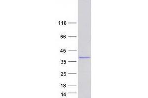 Western Blotting (WB) image for Calponin 2 (CNN2) (Transcript Variant 2) protein (Myc-DYKDDDDK Tag) (ABIN2713069)