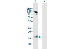 Western Blot analysis of RARRES2 expression in transfected 293T cell line by RARRES2 MaxPab polyclonal antibody. (Chemerin 抗体  (AA 1-163))
