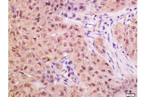 Immunohistochemistry (Paraffin-embedded Sections) (IHC (p)) image for anti-CTD (Carboxy-terminal Domain, RNA Polymerase II, Polypeptide A) Small Phosphatase 2 (CTDSP2) (AA 25-150) antibody (ABIN2559702)