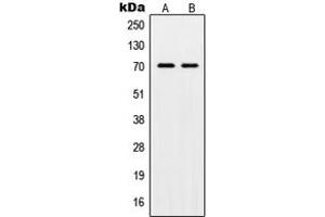 Western blot analysis of POT1 expression in HL60 (A), HeLa (B) whole cell lysates. (POT1 抗体  (Center))