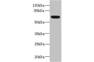 Western blot All lanes: ALCAMantibody IgG at 5. (CD166 抗体  (AA 28-180))
