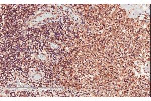 ABIN625822 (2µg/ml) staining of paraffin embedded Human Lymph Node. (CD28 抗体  (Internal Region))