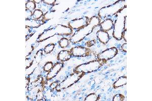 Immunohistochemistry (IHC) image for anti-Interleukin 23 Receptor (IL23R) (AA 405-629) antibody (ABIN3022246)
