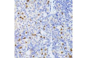 Immunohistochemistry of paraffin-embedded mouse spleen using SMAD2 antibody. (SMAD2 抗体  (AA 1-100))