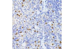 Immunohistochemistry of paraffin-embedded mouse spleen using SMAD2 antibody. (SMAD2 抗体  (AA 1-100))