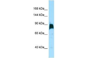 Western Blotting (WB) image for anti-Kinesin Family Member 7 (KIF7) (C-Term) antibody (ABIN2490336) (KIF7 抗体  (C-Term))
