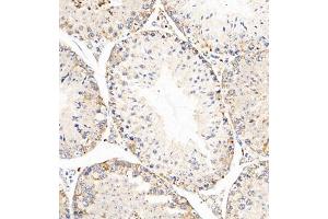 Immunohistochemistry of paraffin embedded mouse testis using AZI2 (ABIN7072856) at dilution of 1:650 (300x lens) (AZI2 抗体)